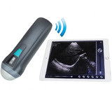 Hot Wireless MINI IOSHome use ultrasound equipment ultrasound B Scanner Uprobe-1