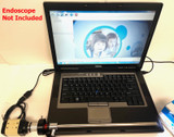 Rigid Endoscope Hd 4k 8mp Usb Video Camera Head with Light Source