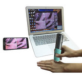 Portable Hd Wireless Wifi Digital Microscope For Medical Cosmetology 2Mp 600X