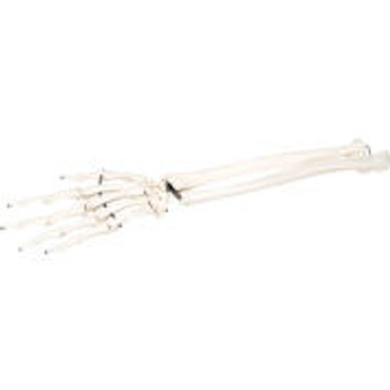 3B® Anatomical Model - Loose Bones, Hand Skeleton with Ulna and Radius, Right