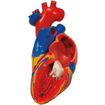 3B® Anatomical Model - Heart with Bypass, 2-Part