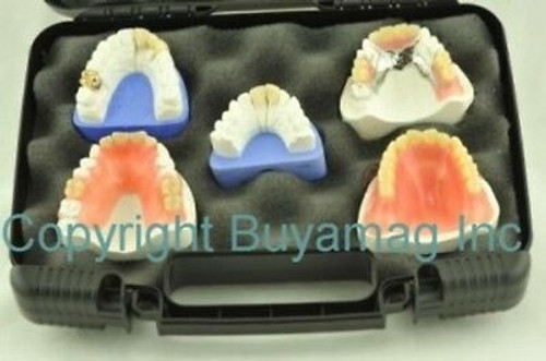 Dental Restoration Model Patient Education Kit 5Pc. New In Carrying Storage Case