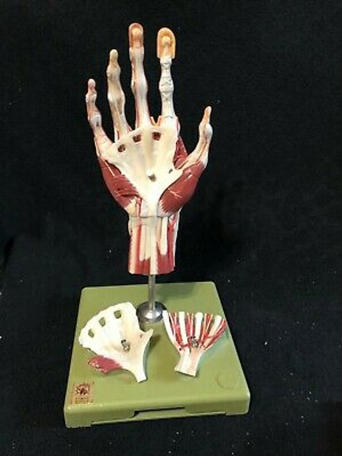 Somso Surgical Hand Anatomical Model Muscles Tendons Nerves Vessels Ns13/1