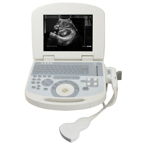 Laptop Ultrasound Scanner Diagnostic Ultrasonic Machine +Convex/Curve Probe +3D