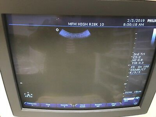 Philips Hd11 Crt Monitor Model 453561166991/Mcmd02Aa/Mc15601