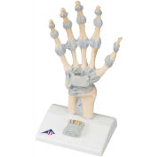 3B® Anatomical Model - Hand Skeleton with Ligaments