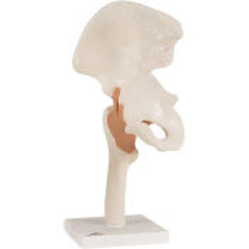 3B® Anatomical Model - Functional Hip Joint