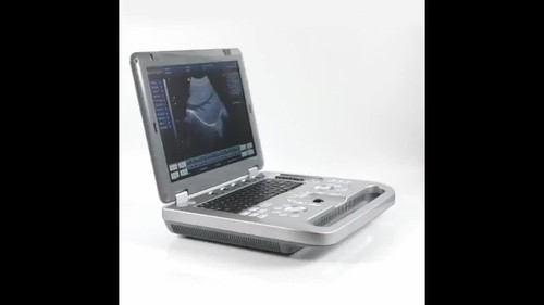 Best price clinic use  portable ultrasound machine price 3D color display ultrasound SUN-800D