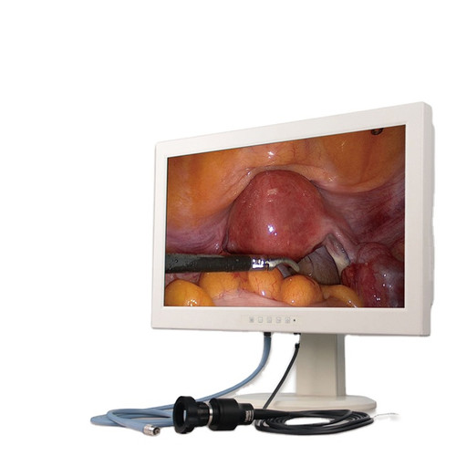 All-in-one Integrated HD endoscopy medical monitor system arthroscopy