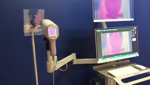 Kernel KN2200I(H) full HD sony camera digital Video Colposcope for gynecology cervix vagina examination