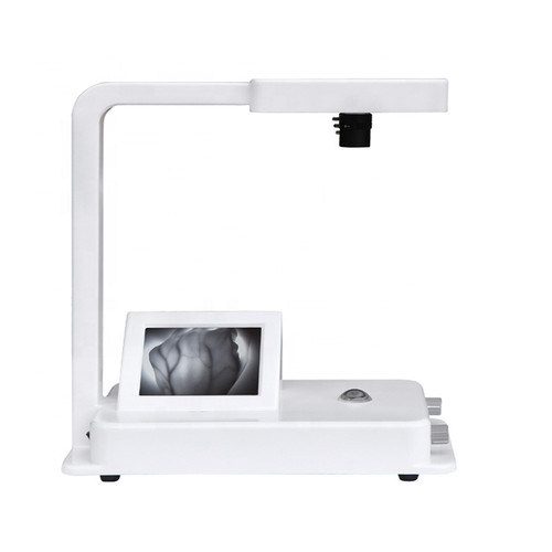 China Best Price Portable Vein finder clear version