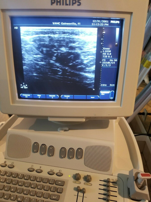 PHILIPS ENVISOR HD M2540A ULTRASOUND MACHINE, with L1038 & 15-6L Probes