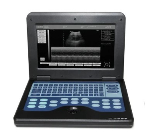 Portable Laptop Machine Digital Ultrasound Scanner,3.5 Convex Probe CMS600P2