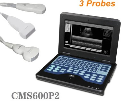 Portable Laptop Machine Digital Ultrasound Scanner, Convex+Linear+transvaginal 3 Probes