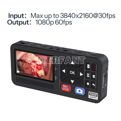 New Medical Portable Surgical Recorder F Laparoscopy and Endoscopy Capture