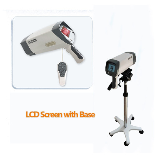 New Digital Colposcope with Built-in Screen for Gynecological Examination &