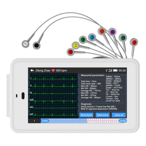 NEW 6/12-lead Electrocardiograph ECG EKG Machine Glasgow ECG Interpretation