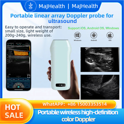 New High quality portable wireless medical ultrasound linear array HD color