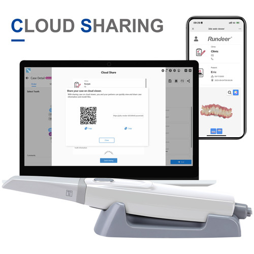 New Dental 3D Intraoral Scanner for CAD/CAM Dentistry