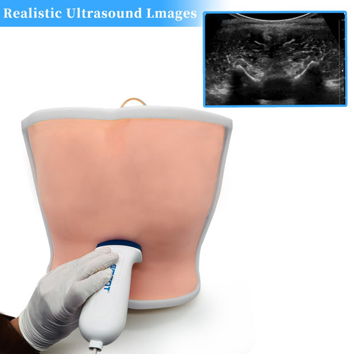 New Ultrasound Guided Lumbar Puncture Model,Simulated Cerebral Myeloid