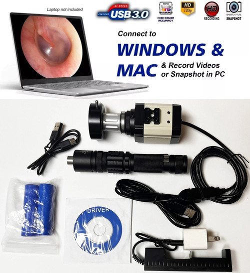 Rigid Endoscope Hd Usb Camera Head with Led Light Source