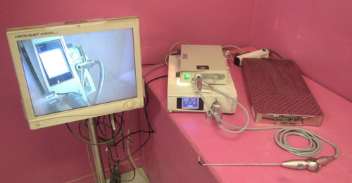 Stryker Ideal Eyes Camera Processor with Video Laparoscope System