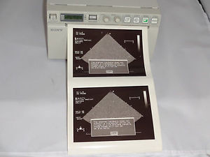 NEW Video Printer for B- Ultrasound scanner System + AV cable + paper Sony