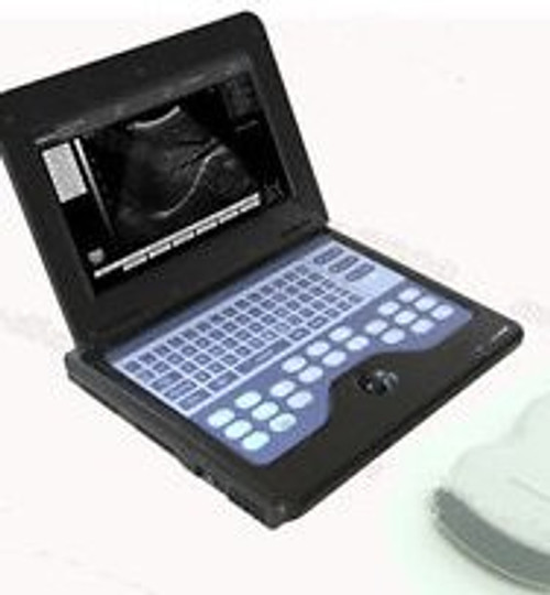 CE laptop B-Ultrasound Scanner system Ultrasound machine+3.5Convex Probe 600P2