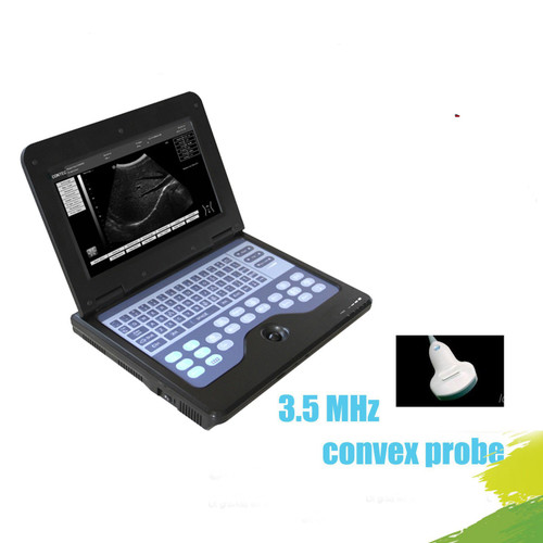 CMS600P2 Smart Laptop Ultrasound Scanner,B-Ultrasound Machine with convex probe