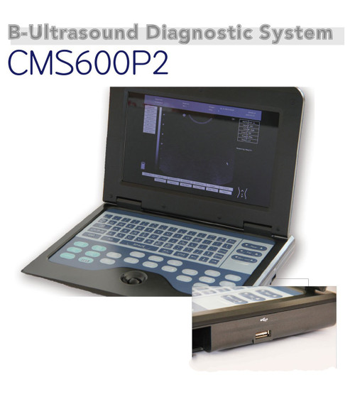 Notebook/Lapto B-Ultrasonic Diagnostic System+7.5Mhz Linear Probe