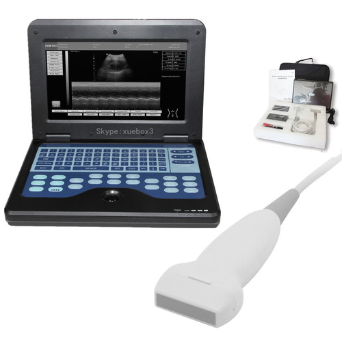 Big sale, Digital Portable Ultrasound Scanner Machine with 7.5MHZ linear probe