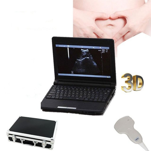 Ultrasound Diagnostic System,Laptop Ultrasound Scanner with 2 Probes,Humans use
