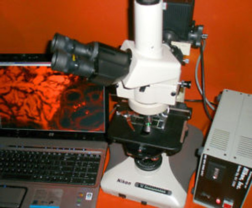 Nikon Optiphot 2 Fluorescence Phase Contrast trinoccular Microscope