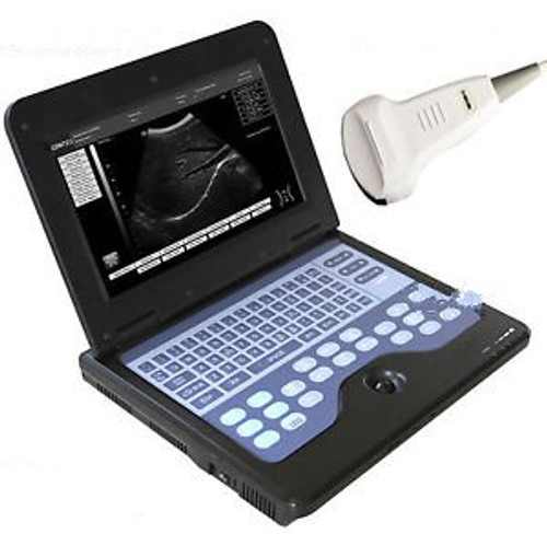 Contec Lcd Portable Digital B-Ultrasound Scanner Diagnostic System  Convex Porbe