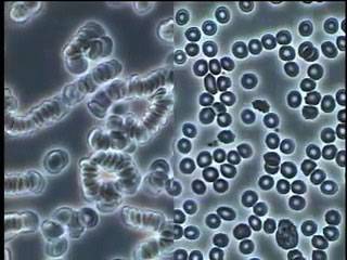 Blood Cells Before and After Subject Consumed Water Treated with the Stir Wand - Photo 1