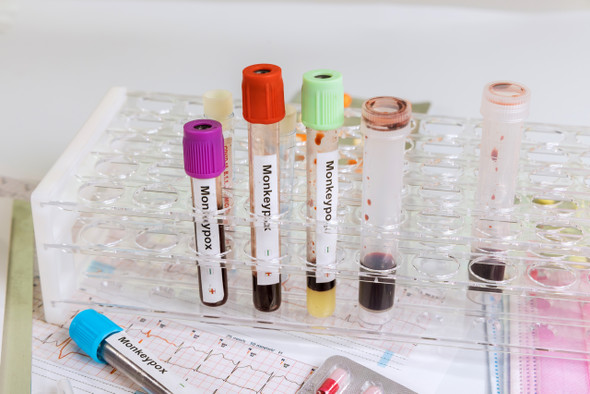 Monkeypox Virus Detection Kit (RT-PCR) Monkeypox Virus Detection Kit (RT-PCR)