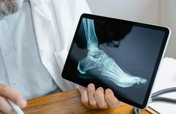xray of foot on iPad