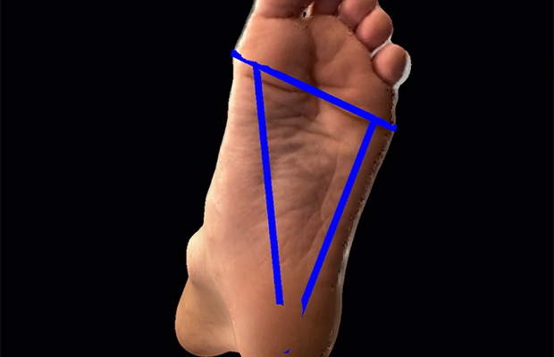 foot with lines