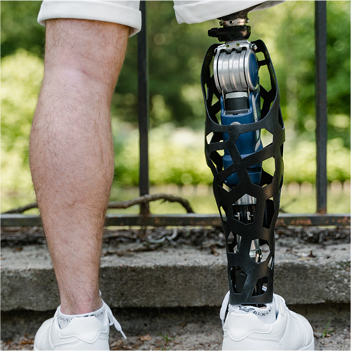 close up of legs, where one is a prosthesis