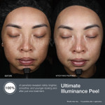 Ultimate Illuminance Peel 60ml
