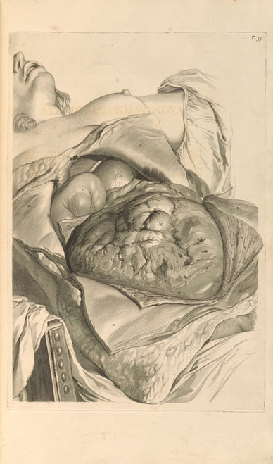 Digital Print - Anatomia humani corporis Pl.056 by Gerard de Lairesse