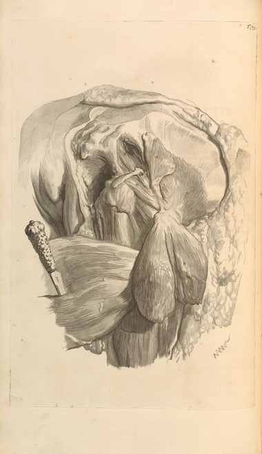 Digital Print - Anatomia humani corporis Pl.074 by Gerard de Lairesse
