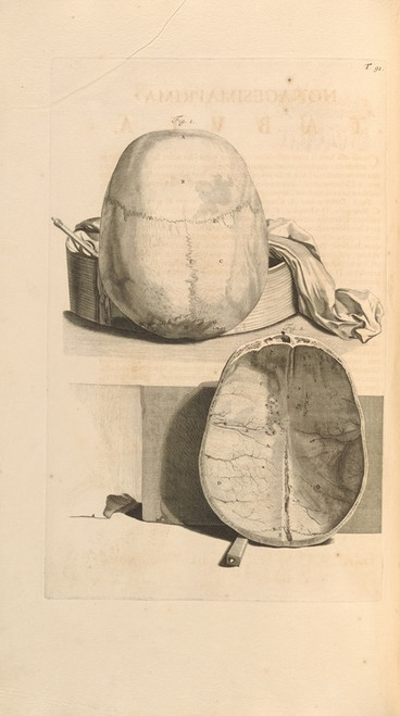 Digital Print - Anatomia humani corporis Pl.092 by Gerard de Lairesse