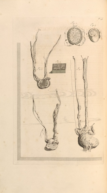 Digital Print - Anatomia humani corporis Pl.047 by Gerard de Lairesse