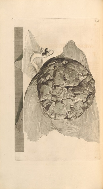 Digital Print - Anatomia humani corporis Pl.059 by Gerard de Lairesse