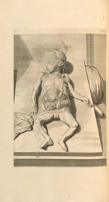 Digital Print - Anatomia humani corporis Pl.063 by Gerard de Lairesse