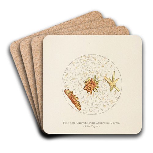 Plate V: Uric Acid Crystals with Amorphous Urates by Charles Wesley Purdy Art Drink Coaster set Plate V: Uric Acid Crystals with Amorphous Urates by Charles Wesley Purdy Art Drink Coaster set