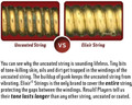 Elixir Bronze Nanoweb - Light / 12-53 Acoustic Strings - 85601-tmpD378.jpg