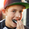 Shock Doctor Fang Double Braces Mouthguard