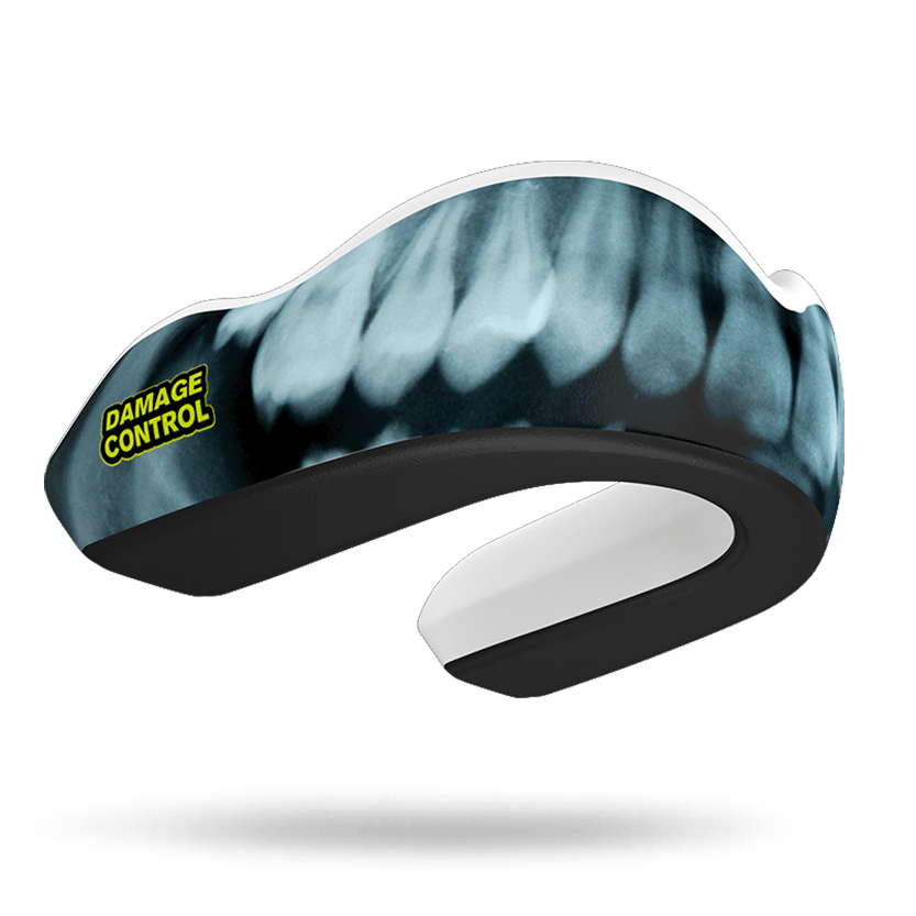 Damage Control X-Ray Extreme Impact Mouthguard